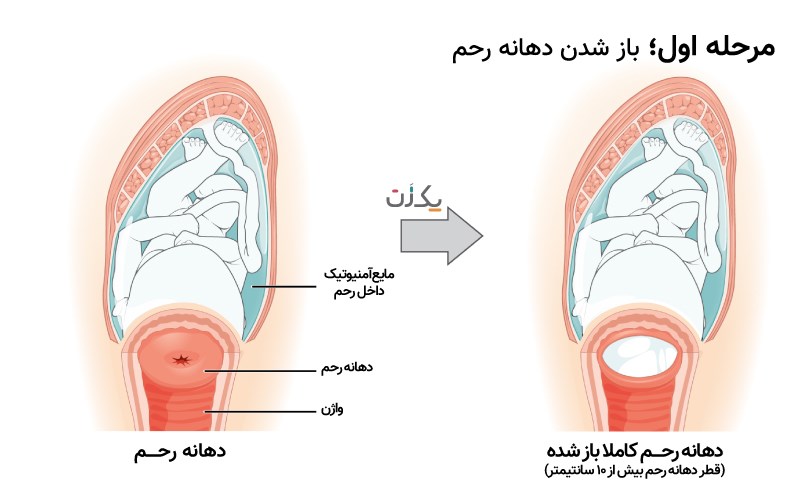 مراحل زایمان طبیعی آموزش زایمان طبیعی یک زن